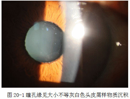 ZY016_102_2.gif